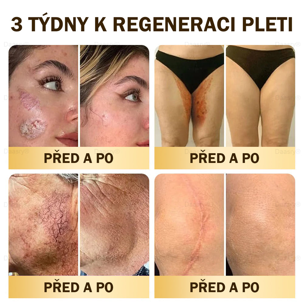 🎇𝓓𝓪𝓪𝓼𝓻𝔂®Krém s včelím jedem pro obnovu a omlazení pleti. Snižuje vrásky, hydratuje, rozjasňuje, hojí jizvičky, zklidňuje citlivou pleť a sjednocuje barvu pleti.