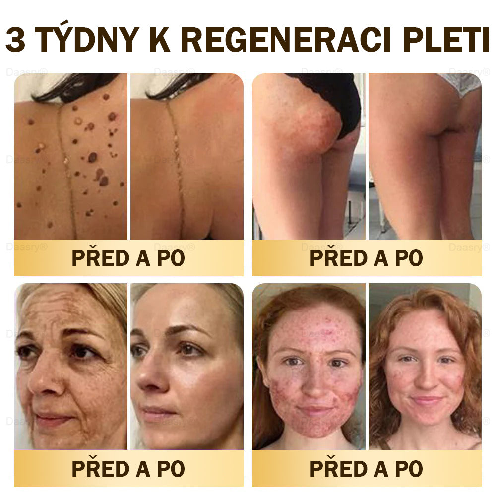 🎇𝓓𝓪𝓪𝓼𝓻𝔂®Krém s včelím jedem pro obnovu a omlazení pleti. Snižuje vrásky, hydratuje, rozjasňuje, hojí jizvičky, zklidňuje citlivou pleť a sjednocuje barvu pleti.