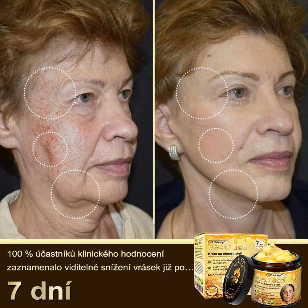 🎇𝓓𝓪𝓪𝓼𝓻𝔂®Krém s včelím jedem pro obnovu a omlazení pleti. Snižuje vrásky, hydratuje, rozjasňuje, hojí jizvičky, zklidňuje citlivou pleť a sjednocuje barvu pleti.