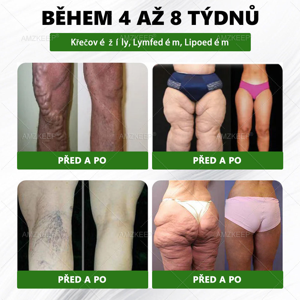 🎁VELIKONOČNÍ VÝPRODEJ 🐰 𝐀𝐌𝐙𝐊𝐄𝐄𝐏® 𝐌𝐨𝐫𝐢𝐧𝐠𝐚 𝐁𝐞𝐫𝐛𝐞𝐫𝐢𝐧 × 𝐍𝐀𝐃+ 𝟏𝟎-𝐢𝐧-𝟏 𝐏𝐨𝐤𝐫𝐨č𝐢𝐥á 𝐍𝐚𝐧𝐨 𝐌𝐢𝐤𝐫𝐨𝐧𝐞𝐞𝐝𝐥𝐞 𝐍á𝐩𝐥𝐚𝐬𝐭 (𝐙𝐚ž𝐢𝐣𝐭𝐞 𝐯𝐢𝐝𝐢𝐭𝐞𝐥𝐧é 𝐯ý𝐬𝐥𝐞𝐝𝐤𝐲 𝐣𝐢ž 𝐳𝐚 𝟕 𝐝𝐧í)