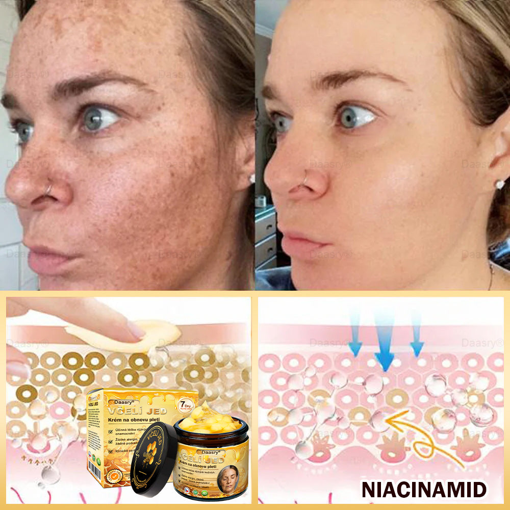 🎇𝓓𝓪𝓪𝓼𝓻𝔂®Krém s včelím jedem pro obnovu a omlazení pleti. Snižuje vrásky, hydratuje, rozjasňuje, hojí jizvičky, zklidňuje citlivou pleť a sjednocuje barvu pleti.